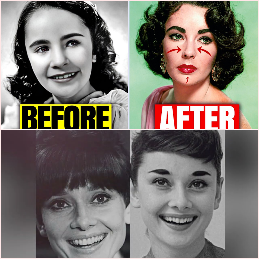 21 Secret Surgeries That Transformed Golden Age Stars Forever. HT