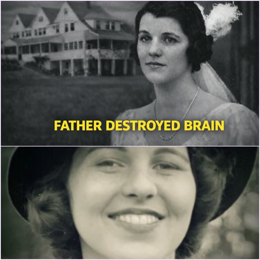 Rosemary Kennedy: Her Father Had Her Brain CUT OPEN While She Was AWAKE & Singing