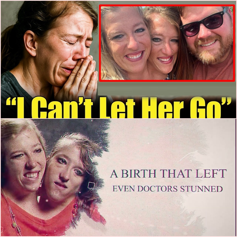 Have You Heard What Happened To Conjoined Twins Abby and Brittany Hensel ht