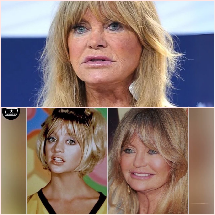 At 79, The Tragedy Of Goldie Hawn Is Beyond Heartbreaking – HT