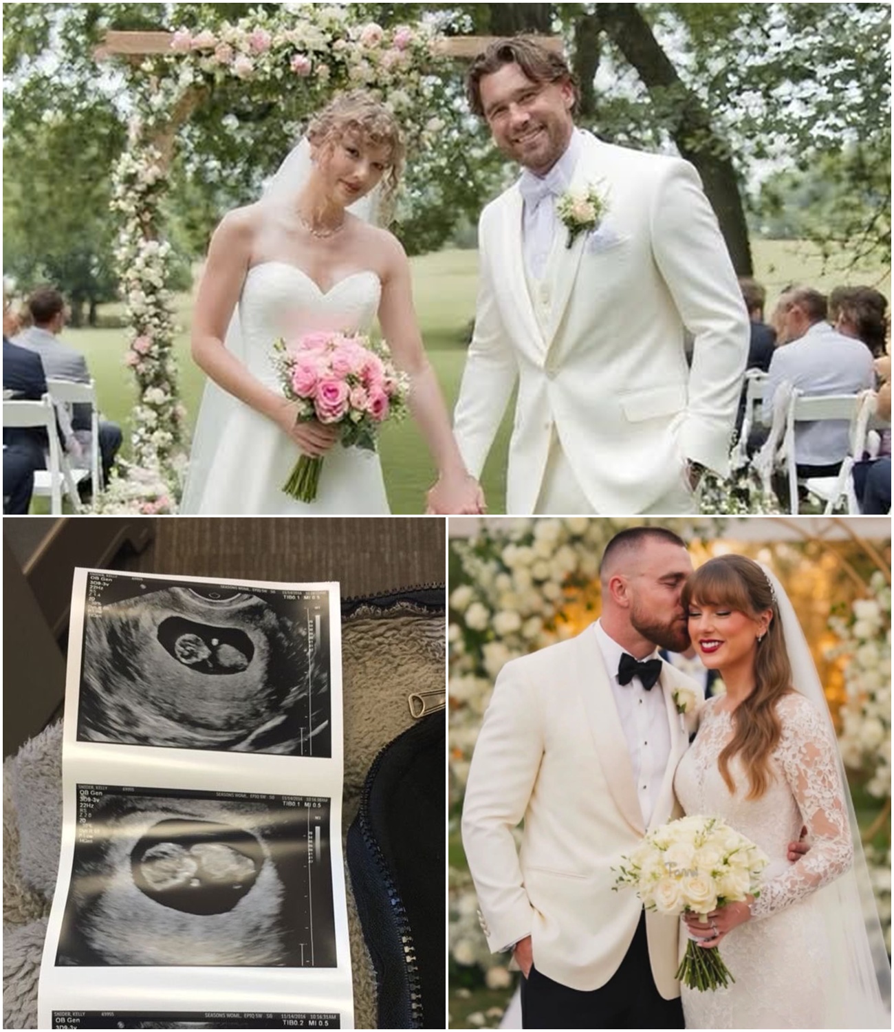 Just 3 Days After Their Wedding, Taylor Swift Goes Live to Reveal She’s Pregnant With Twins — Shares Emotional Message About Motherhood and Even Teases Their Names… See More